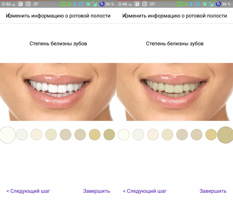 Обзор электрической зубной щетки Soocare X3 от Xiaomi